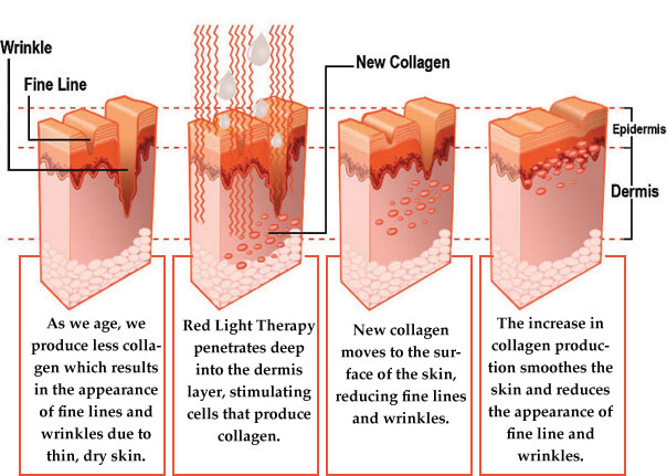 redlighttherapy5